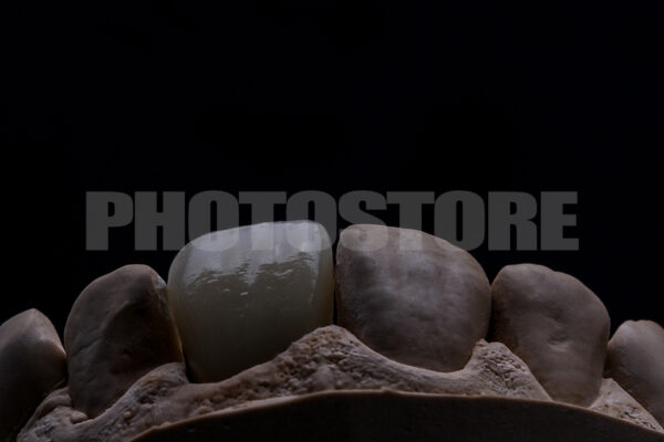 KER1 | dentale Bilder
