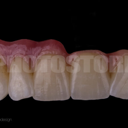 KER11 | dentale Bilder