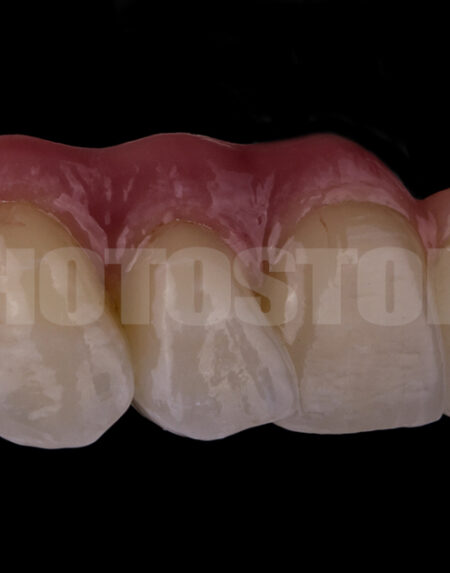 KER12 | dentale Bilder