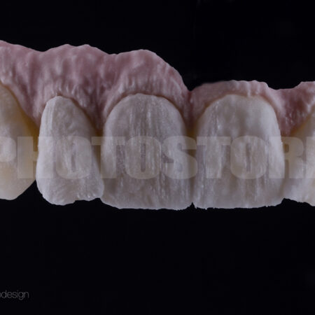 KER13 | dentale Bilder