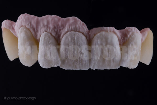 KER13 | dentale Bilder