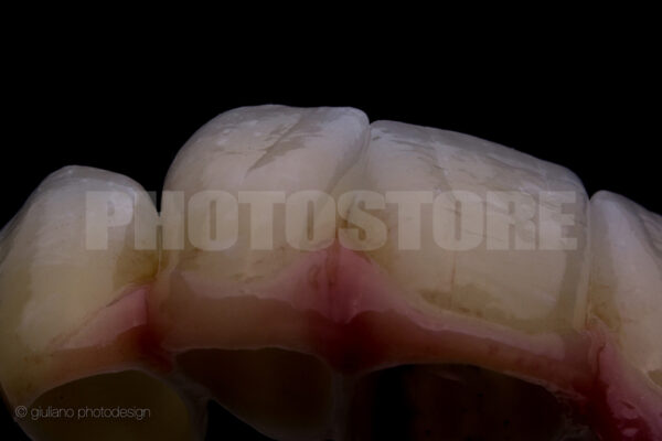 KER14 | dentale Bilder