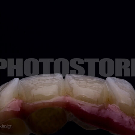 KER15 | dentale Bilder