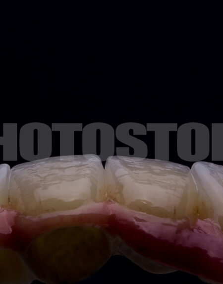 KER15 | dentale Bilder