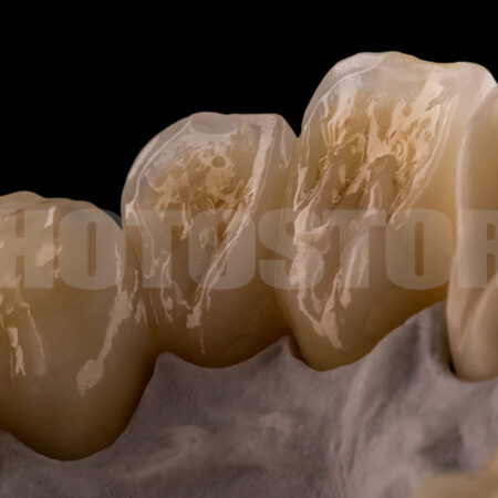 KER18 | dentale Bilder