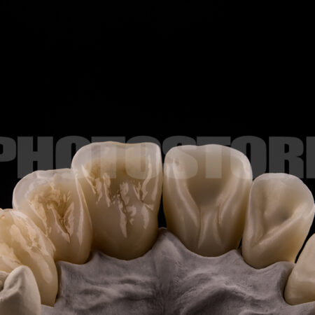 KER19 | dentale Bilder