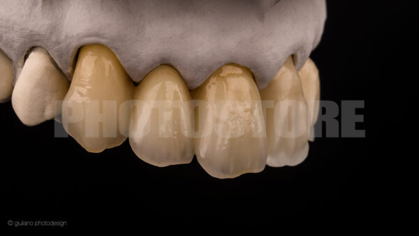KER20 | dentale Bilder