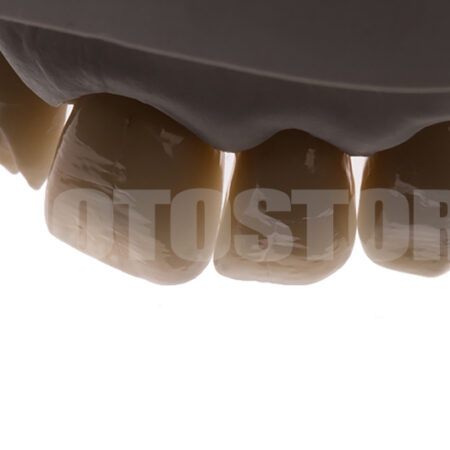 KER26 | dentale Bilder