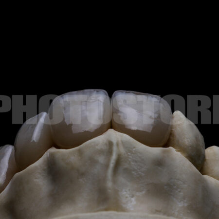 KER3 | dentale Bilder