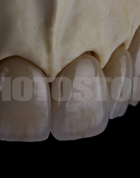 KER4 | dentale Bilder