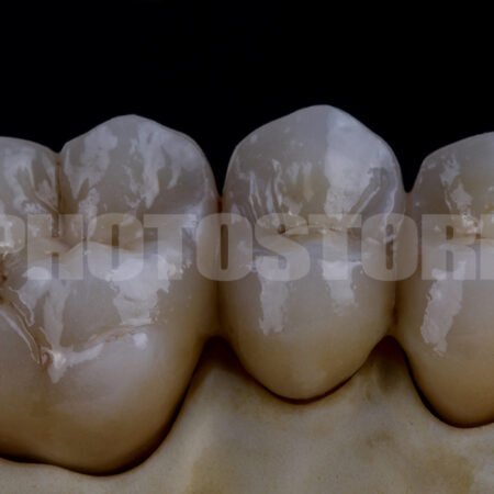 KER5 | dentale Bilder