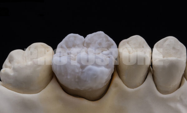 KER8 | dentale Bilder