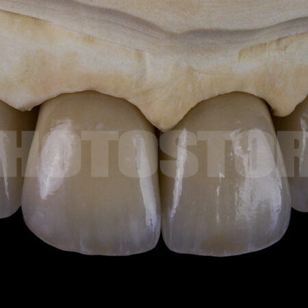 KER9 | dentale Bilder